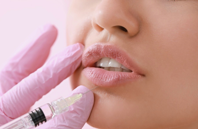Hyaluronidase for Dissolving Unwanted or Migrated Dermal Filler